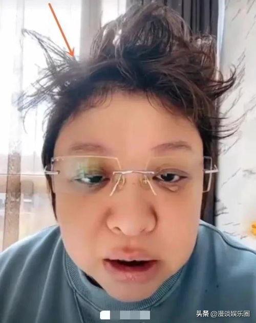 明星网红被感染,揭秘病毒下的生活挑战与应对措施